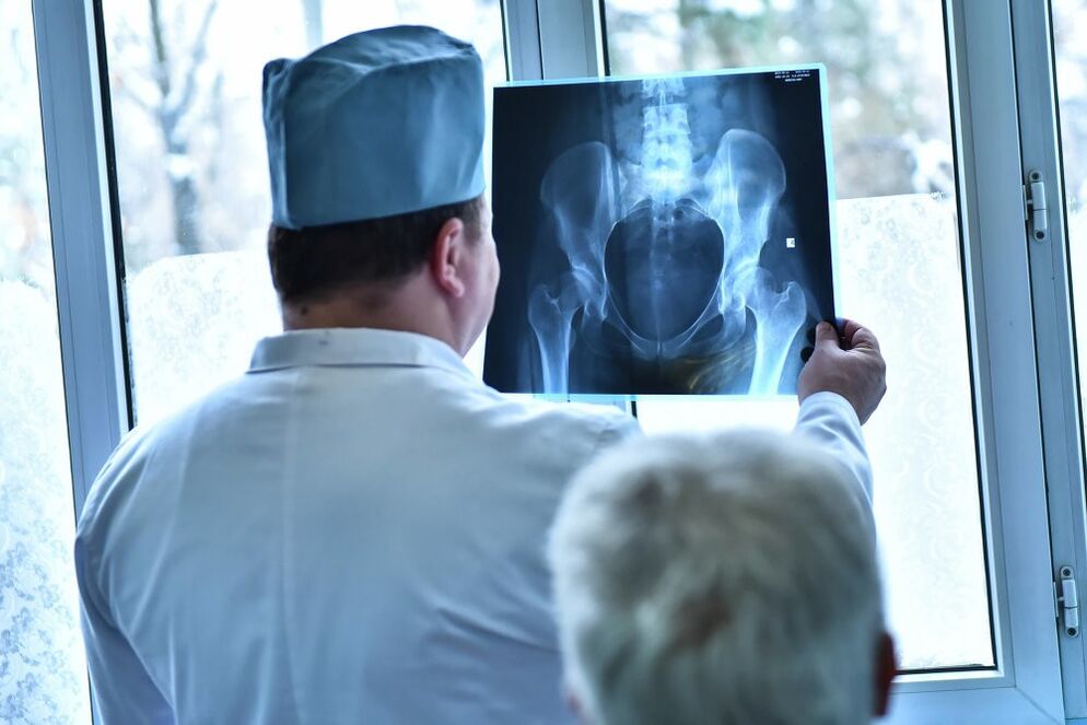 Le médecin regarde une image d’une articulation de la hanche souffrant d’arthrose.